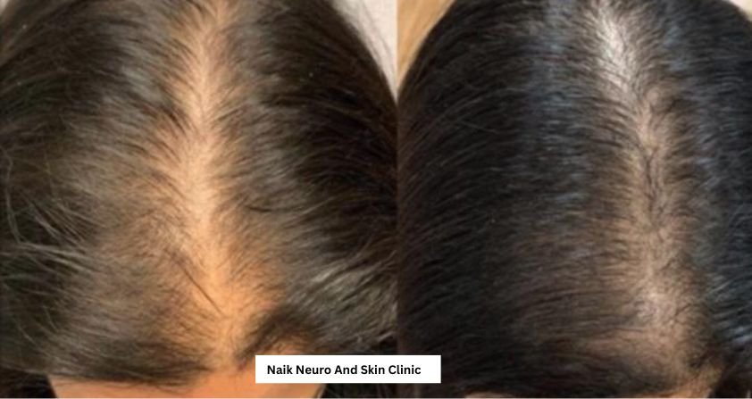 Hair Treatment Result