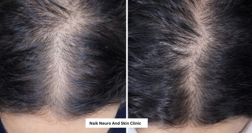 Hair Treatment Result