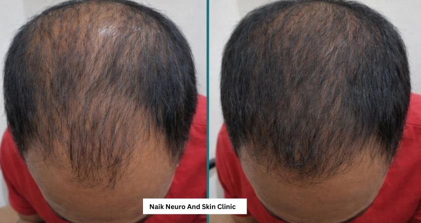 Hair Treatment Result