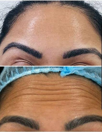 Advanced Skin Treatment