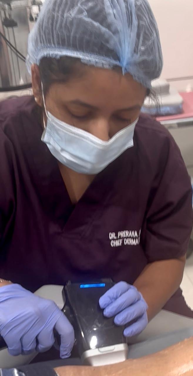 Laser Treatment